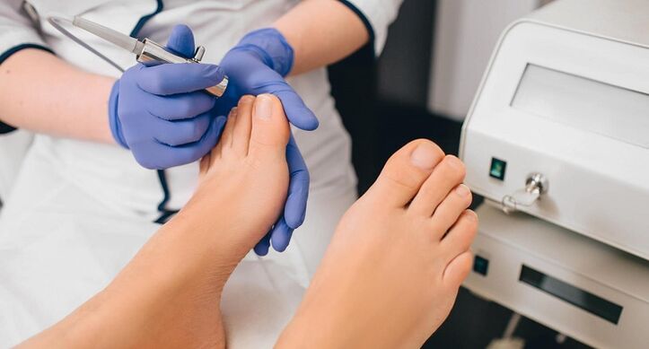 professional treatment of toenail fungus