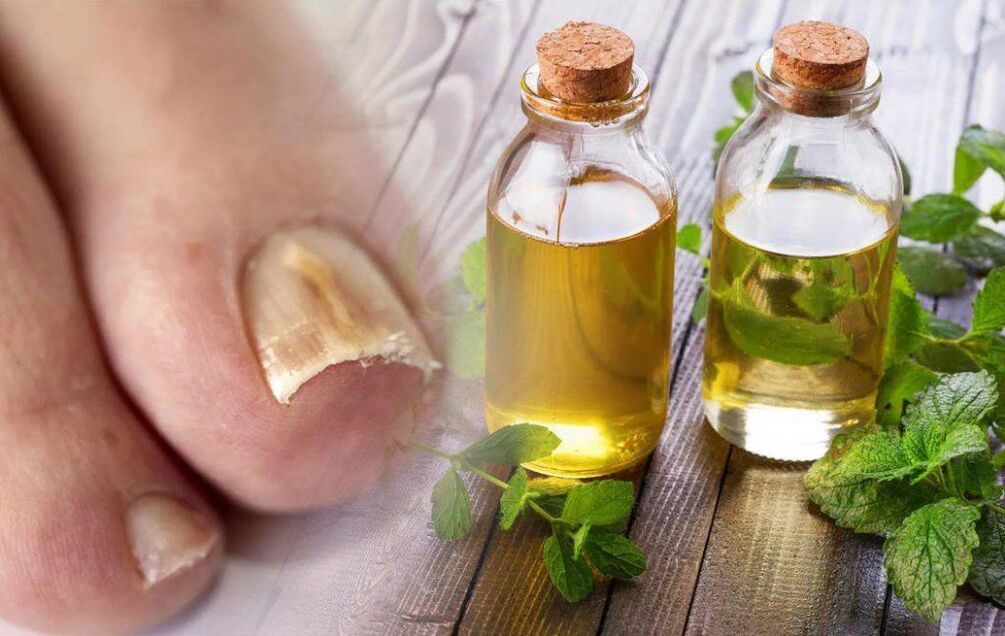 Vinegar for nail fungus